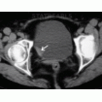 <b>【Ebpay基因检测</b>